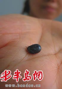河南回應蜱蟲叮咬人致死:3年共發(fā)現(xiàn)245例