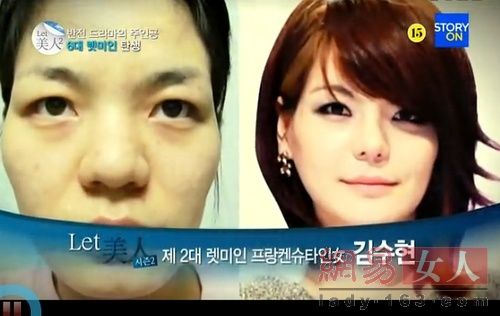 丑女變靚妹！韓國整容節(jié)目爆紅