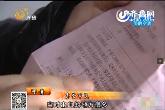 東營：男子與同事辦公室打架被咬臉 對(duì)方拒絕賠償