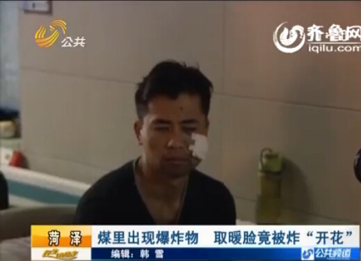 菏澤：煤里出現(xiàn)爆炸物 取暖臉竟被炸“開花”