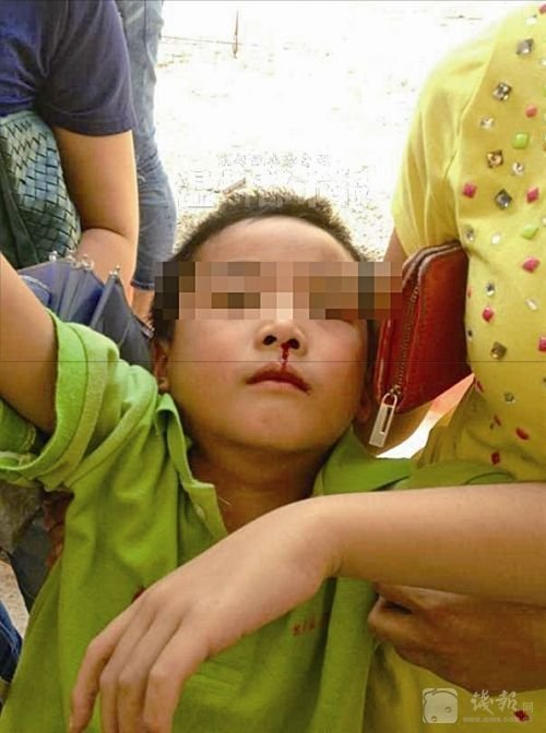 組圖：浙江19名小學(xué)生流鼻血近百人嘔吐 矛頭指向附近工廠