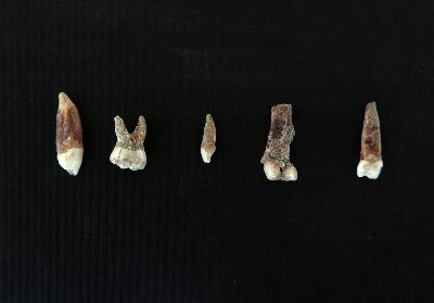 以色列發(fā)現(xiàn)距今40萬年現(xiàn)代人牙齒化石