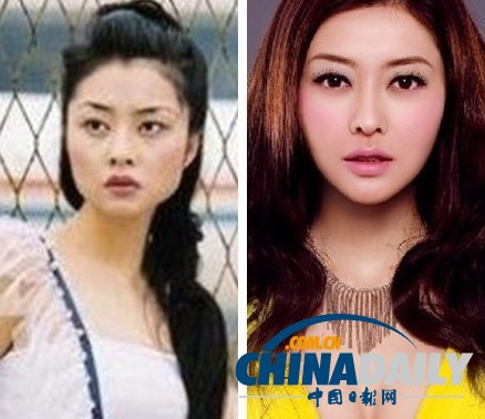 柳巖李小璐楊冪 女星整容前驚人對(duì)比照