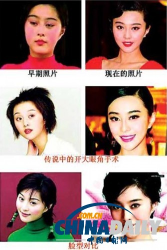 柳巖李小璐楊冪 女星整容前驚人對比照