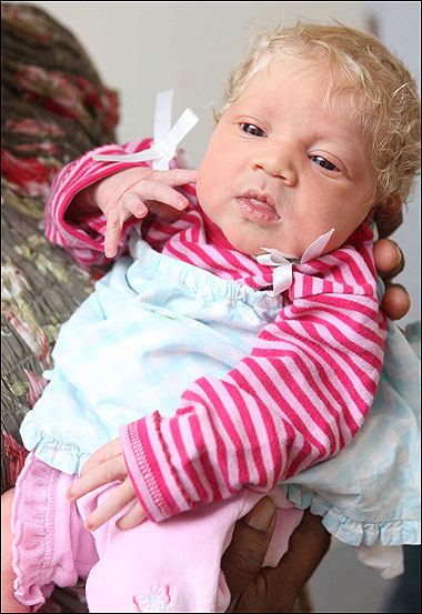 黑人夫婦生出金發(fā)碧眼白人女?huà)?非遺傳非得病惹疑惑