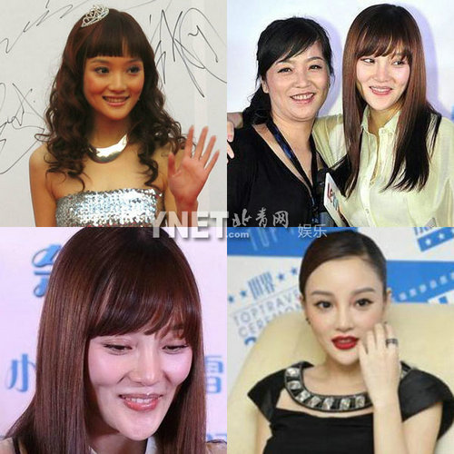 明星整容慘面癱 大S李小璐越發(fā)詭異