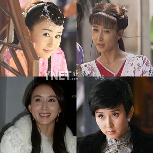明星整容慘面癱 大S李小璐越發(fā)詭異