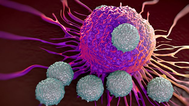 Cancer patients surviving longer in the UK 英國(guó)癌癥患者存活時(shí)間延長(zhǎng)