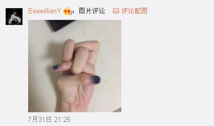 一般人做不出的張一山秋水誓？醫(yī)生：這是??！